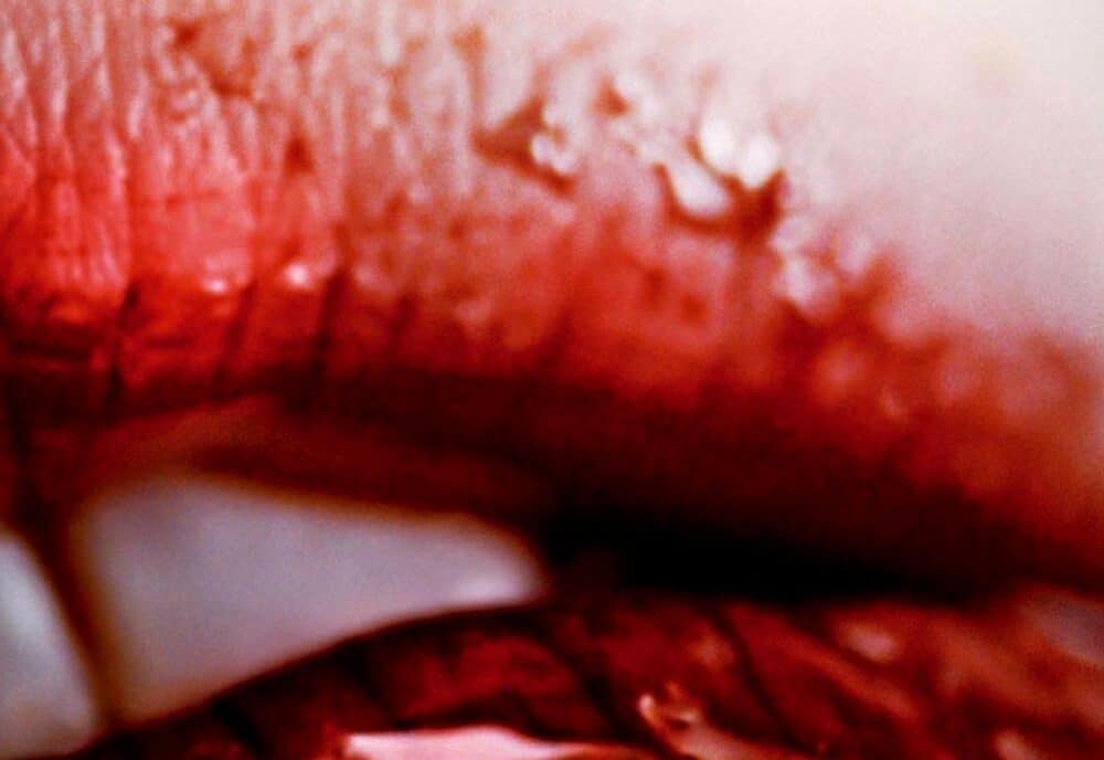Antiviral